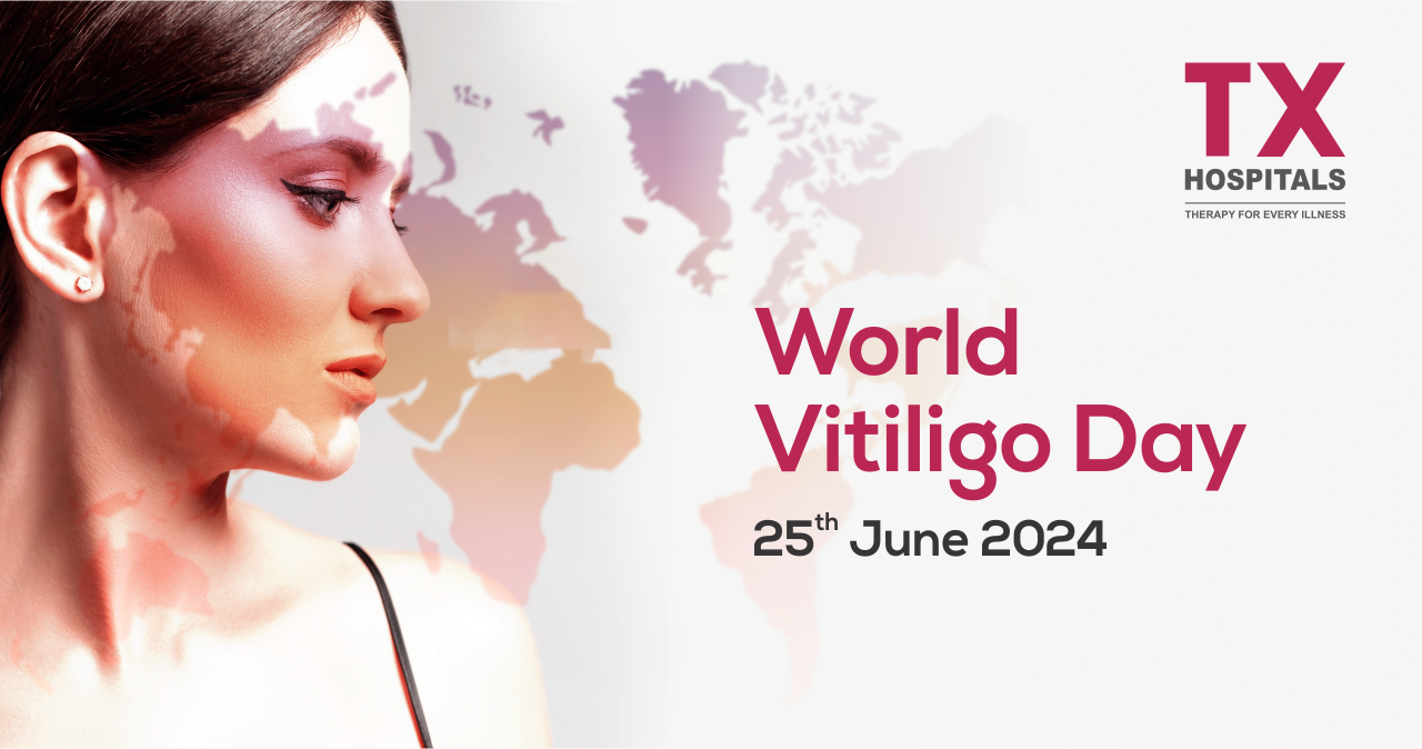 World Vitiligo Day – June 2024