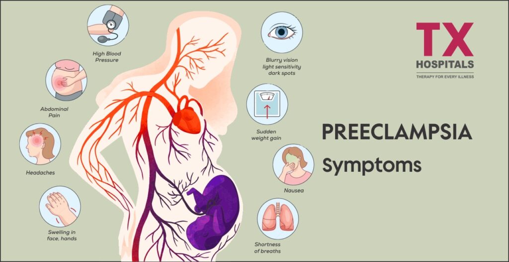 PREECLAMPSIA Symptoms