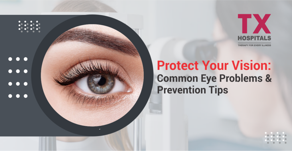 Protect Your Vision Common Eye Problems & Prevention Tips