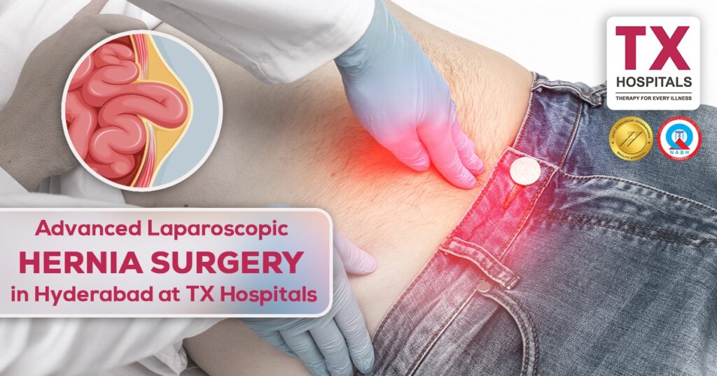 Advanced Laparoscopic HERNIA SURGERY in Hyderabad at TX Hospitals