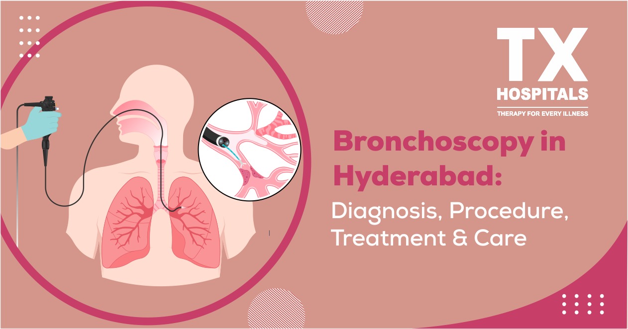 Bronchoscopy in Hyderabad: Diagnosis, Procedure, Treatment & Care