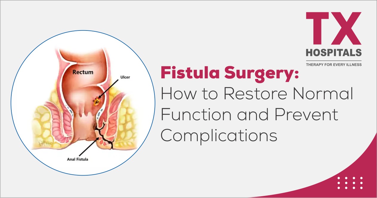 Fistula Surgery: How to Restore Normal Function and Prevent Complications