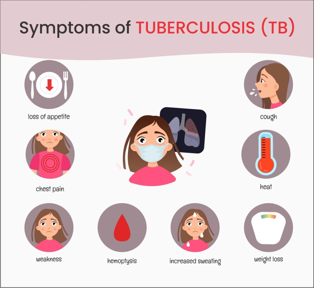 Symptoms of Tuberculosis (TB)